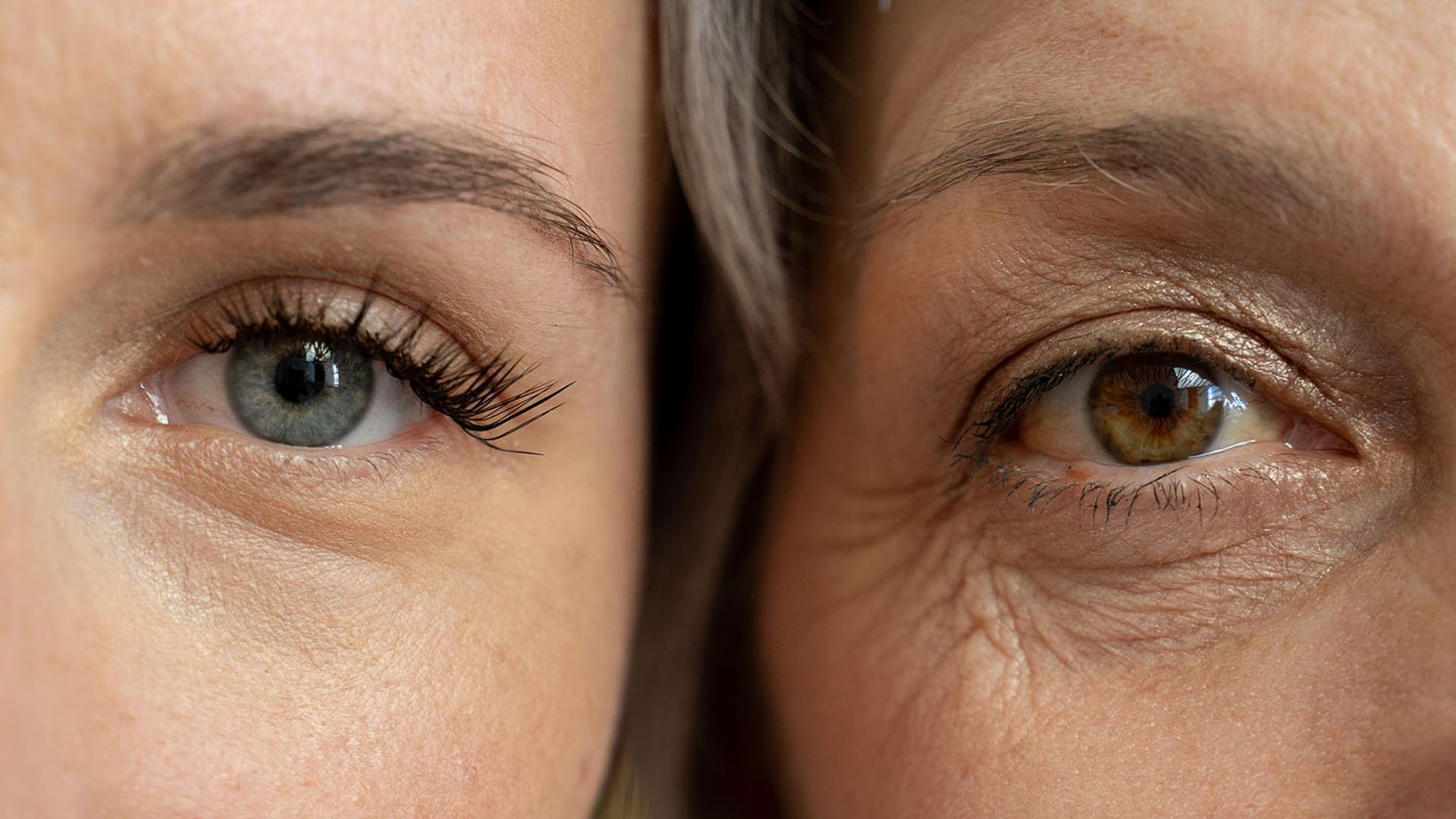 A blue eye with smooth skin next to a brown eye with many wrinkles.