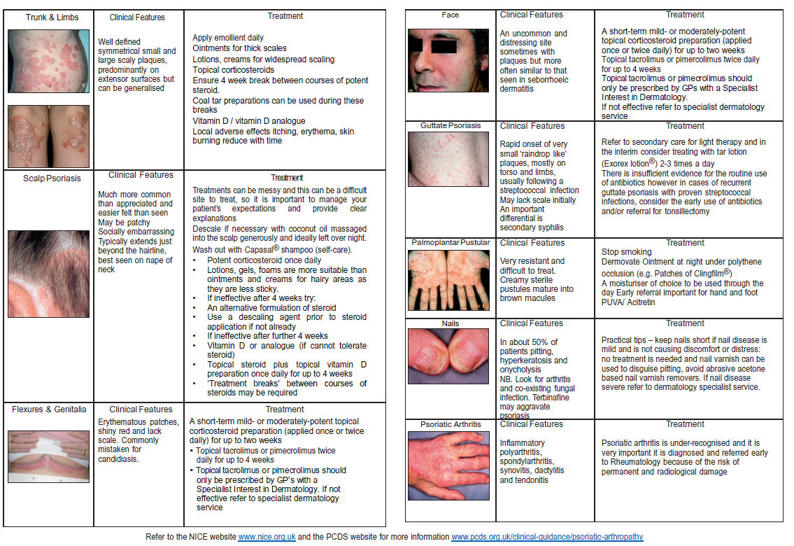 Educational poster showing various types of psoriasis with images, clinical features, and treatment options for each type.