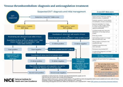 Deep vein thrombosis – GPnotebook