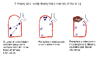 Diagram showing three stages of erythrocyte life cycle in the human body, indicating structural changes and labeled with corresponding stages such as 'supravital,' 'peripheral,' and 'postmature.'