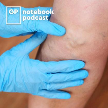 Close-up of a medical professional examining a patient's knee with visible veins, wearing blue gloves, featuring the logo of the GP notebook podcast.