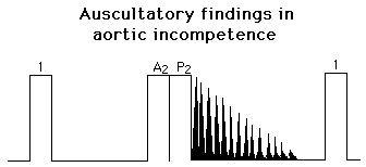 Graphical representation of auscultatory findings in aortic incompetence showing heartbeat peaks and declining waveforms marked as A2 P2.