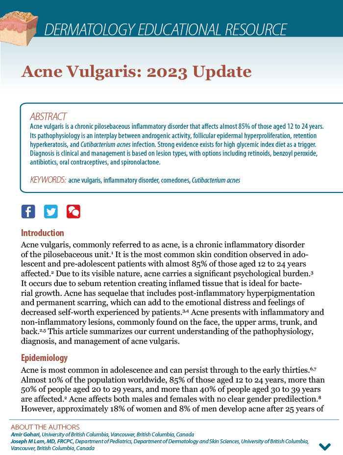 Acne Vulgaris: 2023 Update