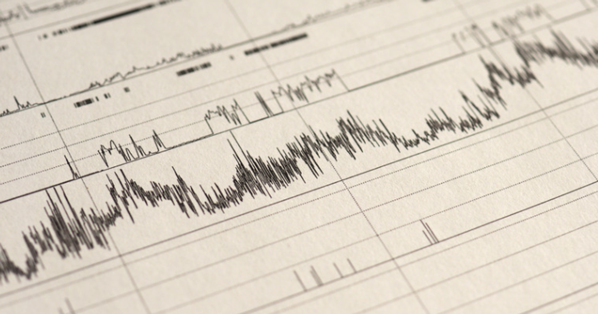 Sleep Study Rdi Meaning AHI and RDI Explained: Sleep Apnea Scores & Severity Index