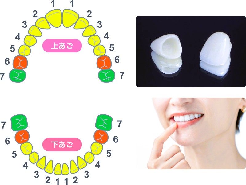 審美歯科｜診療メニュー｜オーク歯科クリニック