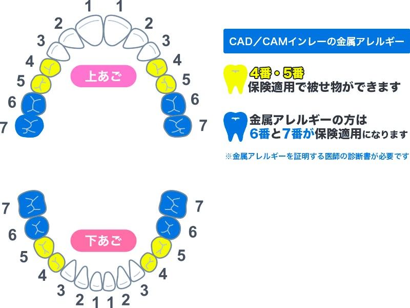 審美歯科｜診療メニュー｜オーク歯科クリニック