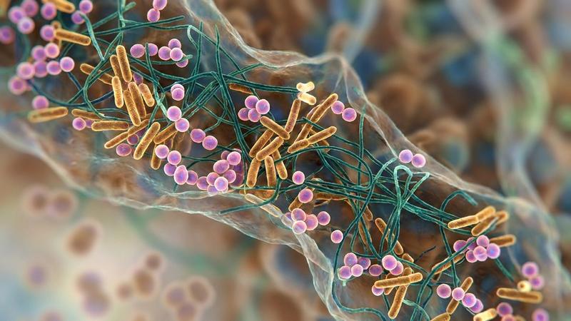 The 5R Gut Health Protocol: A Functional Medicine Framework for 2026