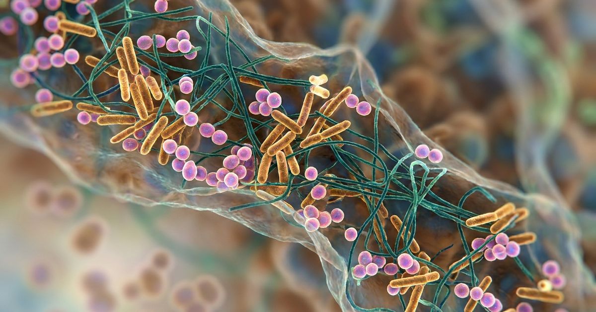 The 5R Gut Health Protocol: A Functional Medicine Framework for 2026