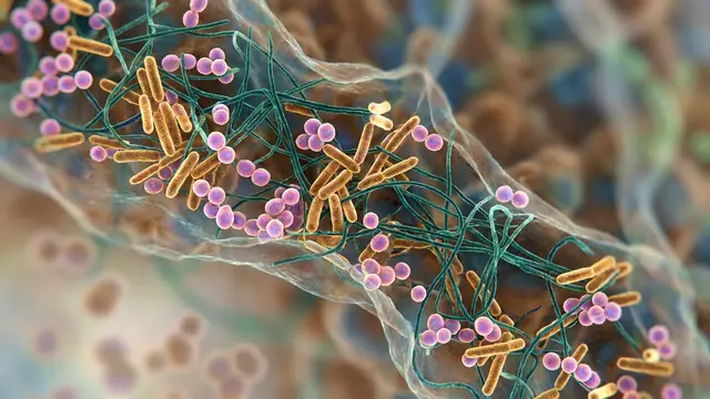 The 5R Gut Health Protocol: A Functional Medicine Framework for 2026