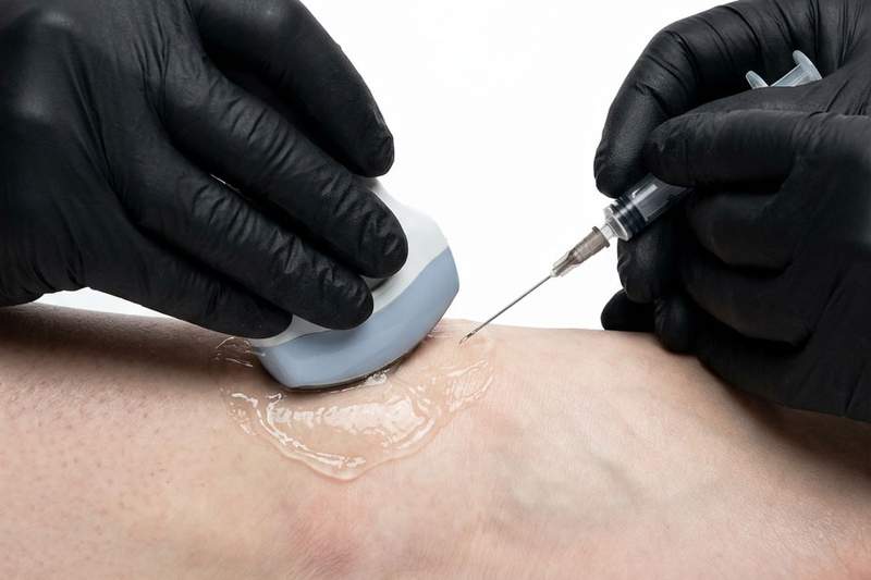 Ultrasound probe guiding an injection at the ankle