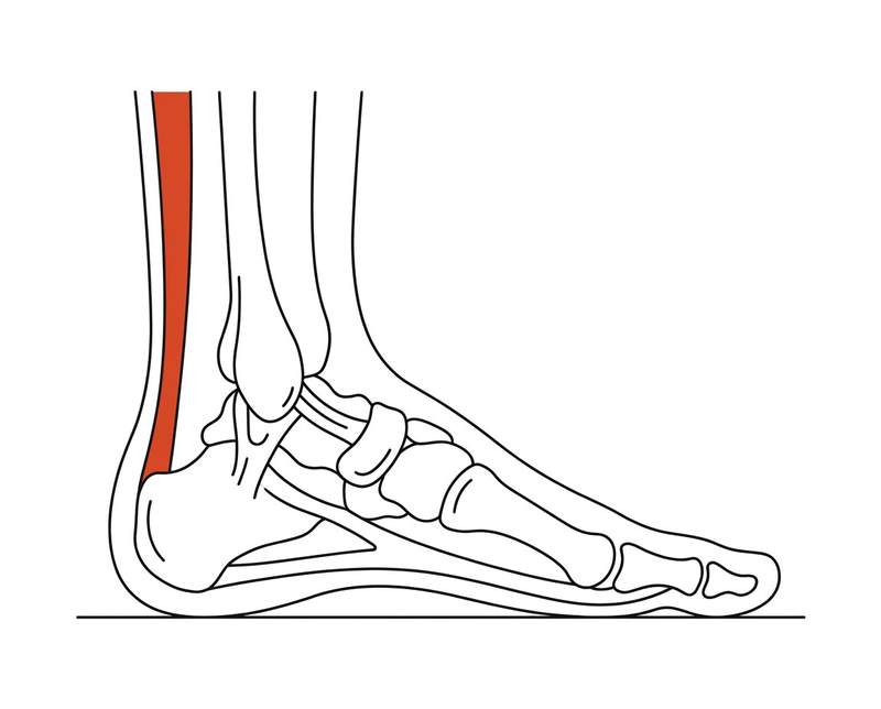 Foot anatomy illustration with the area affected by achilles tendinopathy highlighted