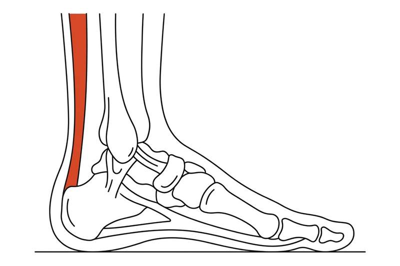 Foot anatomy illustration with the area affected by achilles tendinopathy highlighted