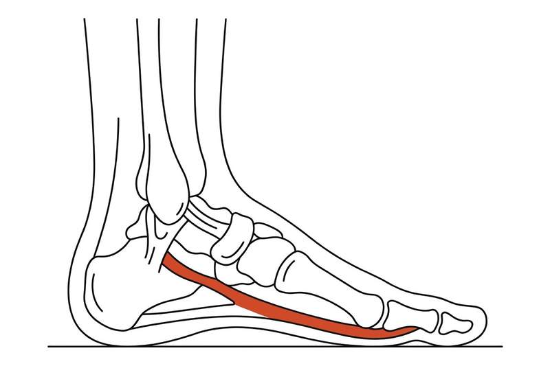 Foot anatomy illustration with the area affected by posterior tibial tendon dysfunction highlighted