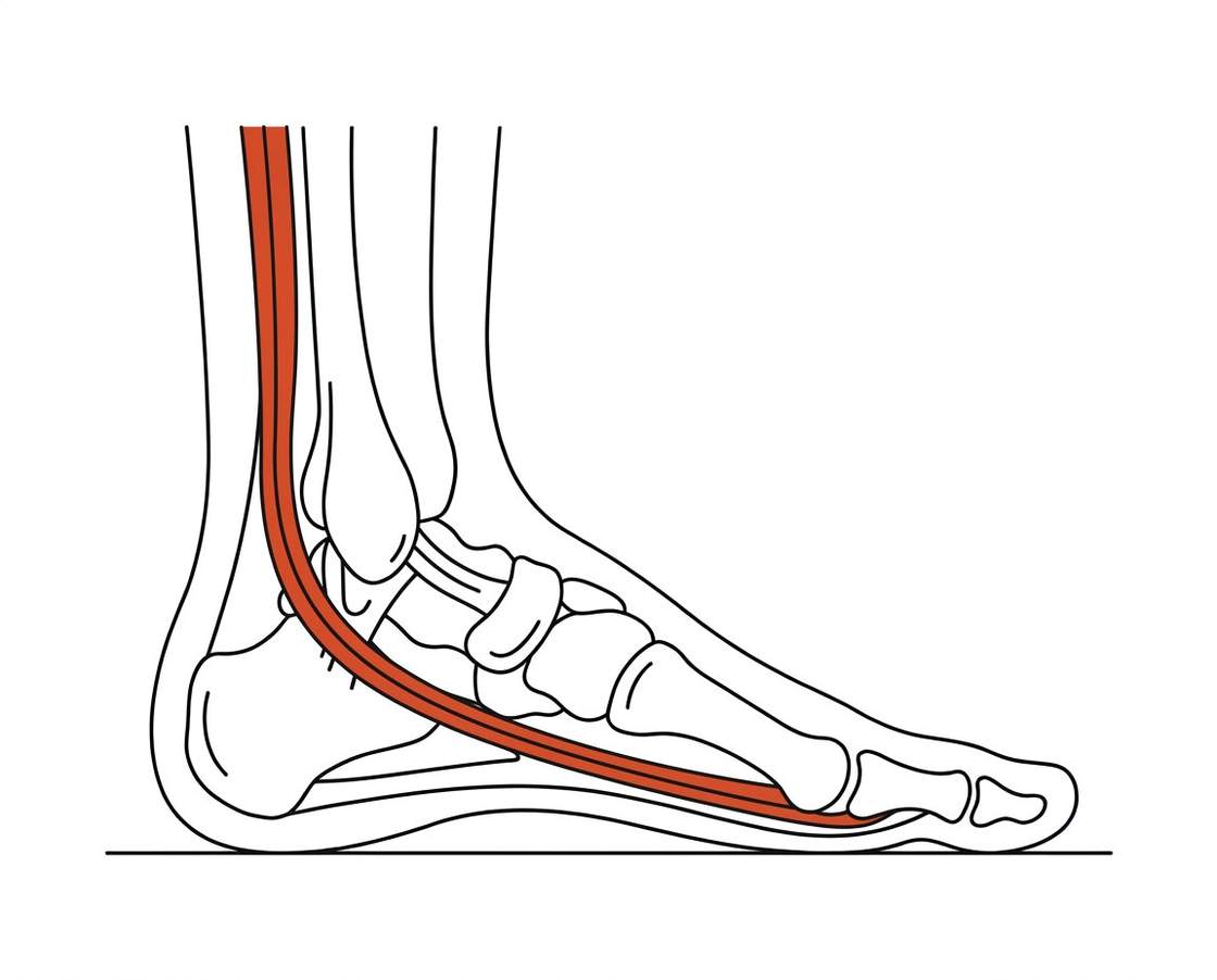 Foot anatomy illustration with the area affected by peroneal tendinopathy highlighted