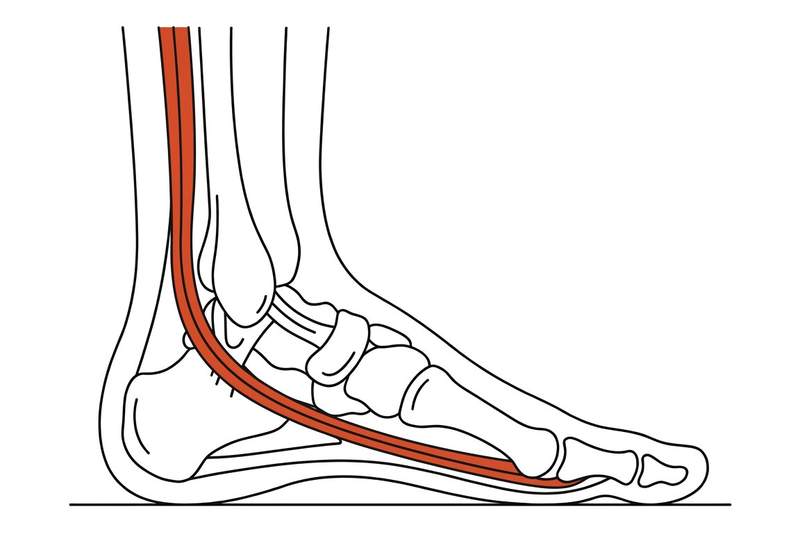 Foot anatomy illustration with the area affected by peroneal tendinopathy highlighted
