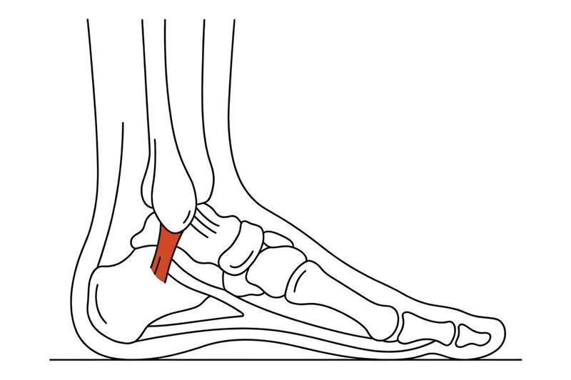 Foot anatomy illustration with the area affected by ankle sprains highlighted