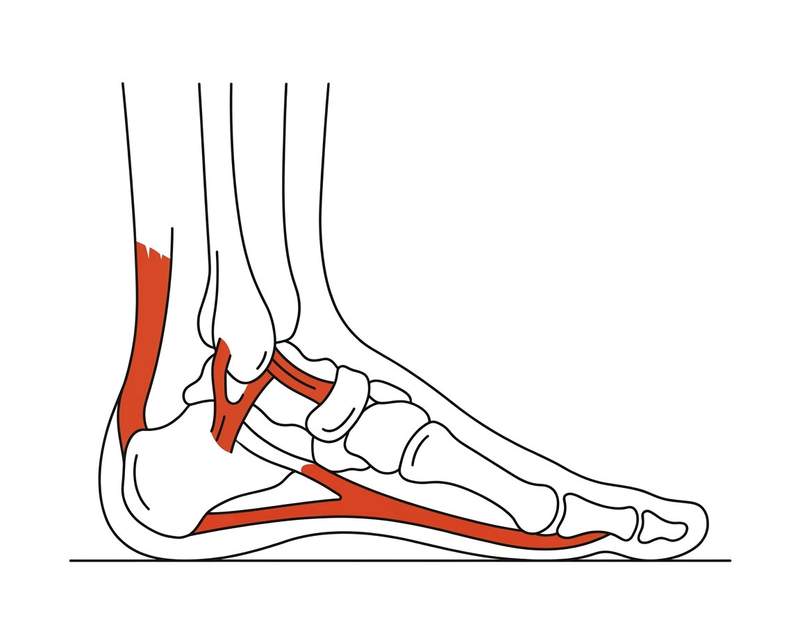 Foot anatomy illustration with the area affected by sports injuries highlighted