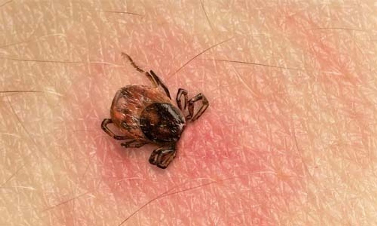 Tick Treatment Options
