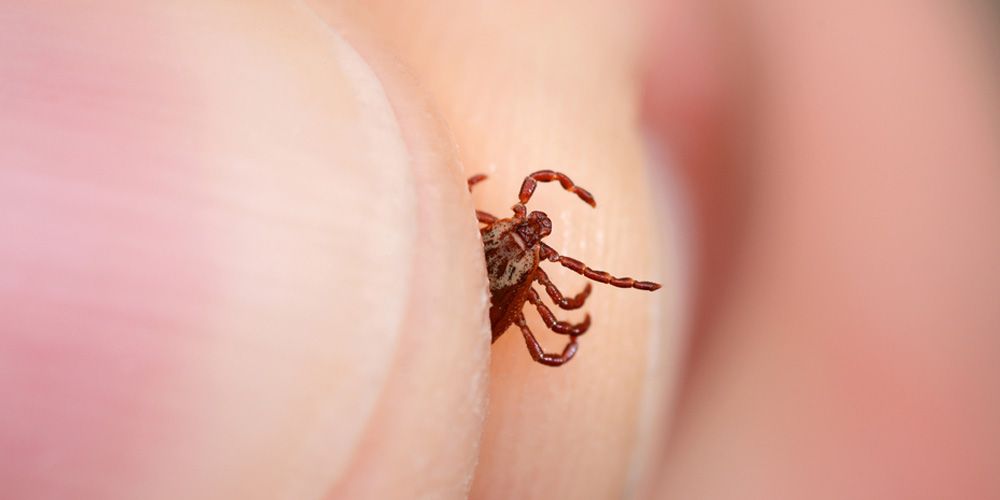 DIY Mite Prevention Tips