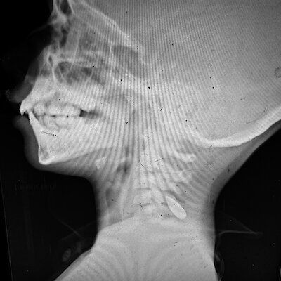 Изображение-image-4e25d0f9a9d1e610fb2d942e6c52e3117d35f7e5-400x400-jpg