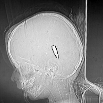 Изображение-image-8da240bdb359b7bef2f4675f529a970ef6e96819-400x400-jpg