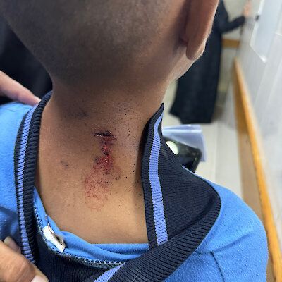 Изображение-image-dc68a5cebe62ea5a4ace61501fd4ee3db2eb6f10-400x400-jpg