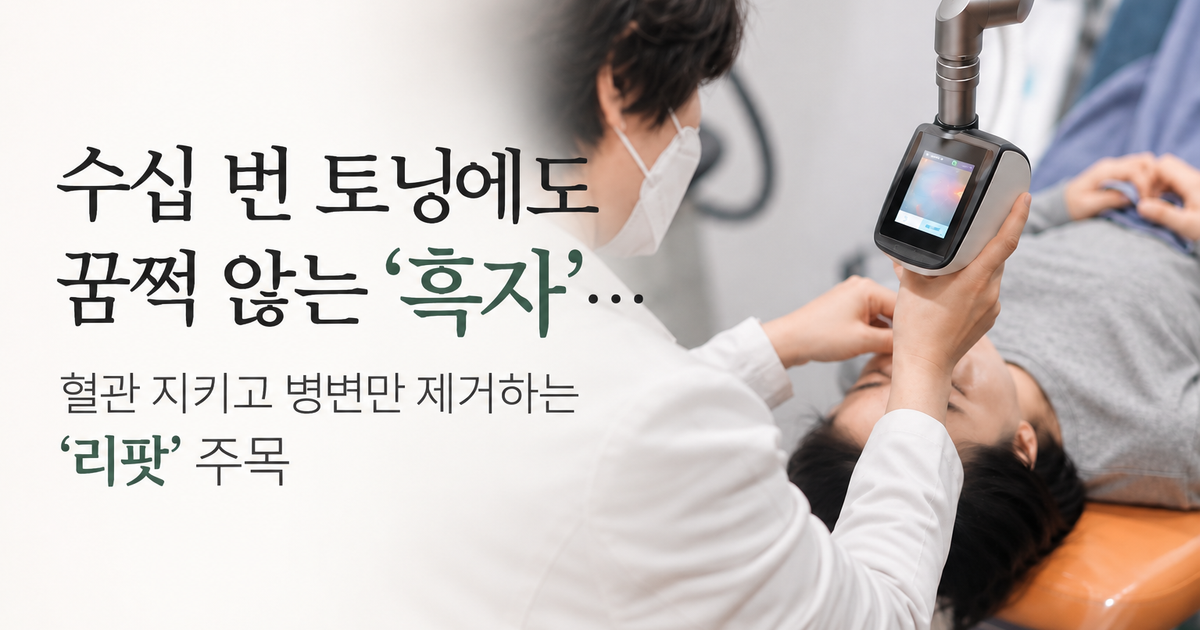 수십 번 토닝에도 꿈쩍 않는 '흑자' 혈관 지키고 병면만 제거하는 '리팟' 주목