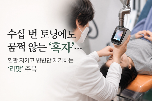 수십 번 토닝에도 꿈쩍 않는 '흑자' 혈관 지키고 병면만 제거하는 '리팟' 주목