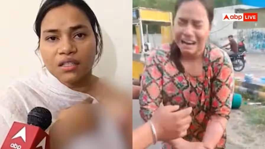 CM के काफिले के दौरान झुलसी रेशू गुप्ता की कहानी: इंसाफ की मांग और इलाज के लिए दर्द
