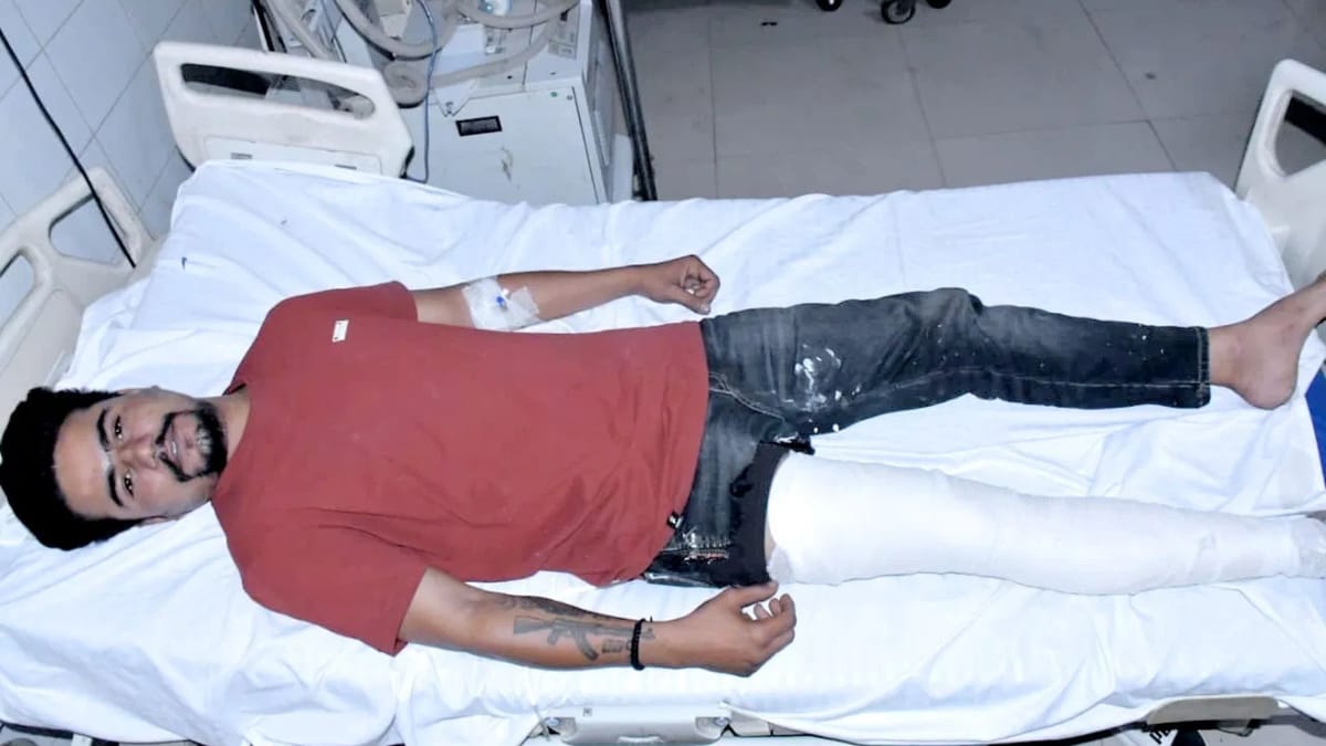 Rajasthan: गैंगवार से पहले पुलिस का एक्शन! हिस्ट्रीशीटर ने पुलिस पर किया फायर, जवाबी गोली से पैर में लगा छर्रा