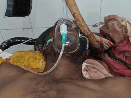 युवक पर कुल्हाड़ी से हमला, सिर में धंसी: बारां में डॉक्टर बाहर नहीं निकाल पाए; कोटा रेफर - Kota News