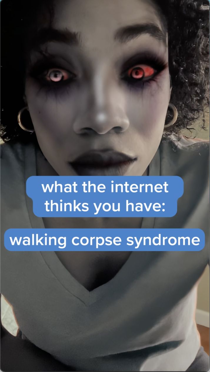 Click to play the "walking corpse" video.