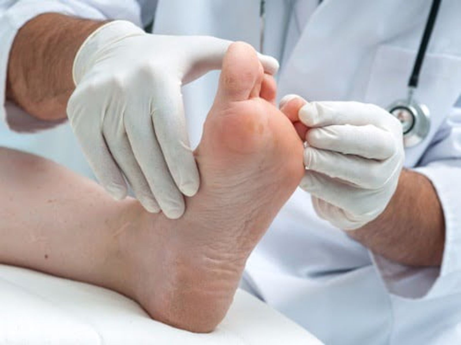 Doctor in white gloves examining patient's swollen foot and ankle.