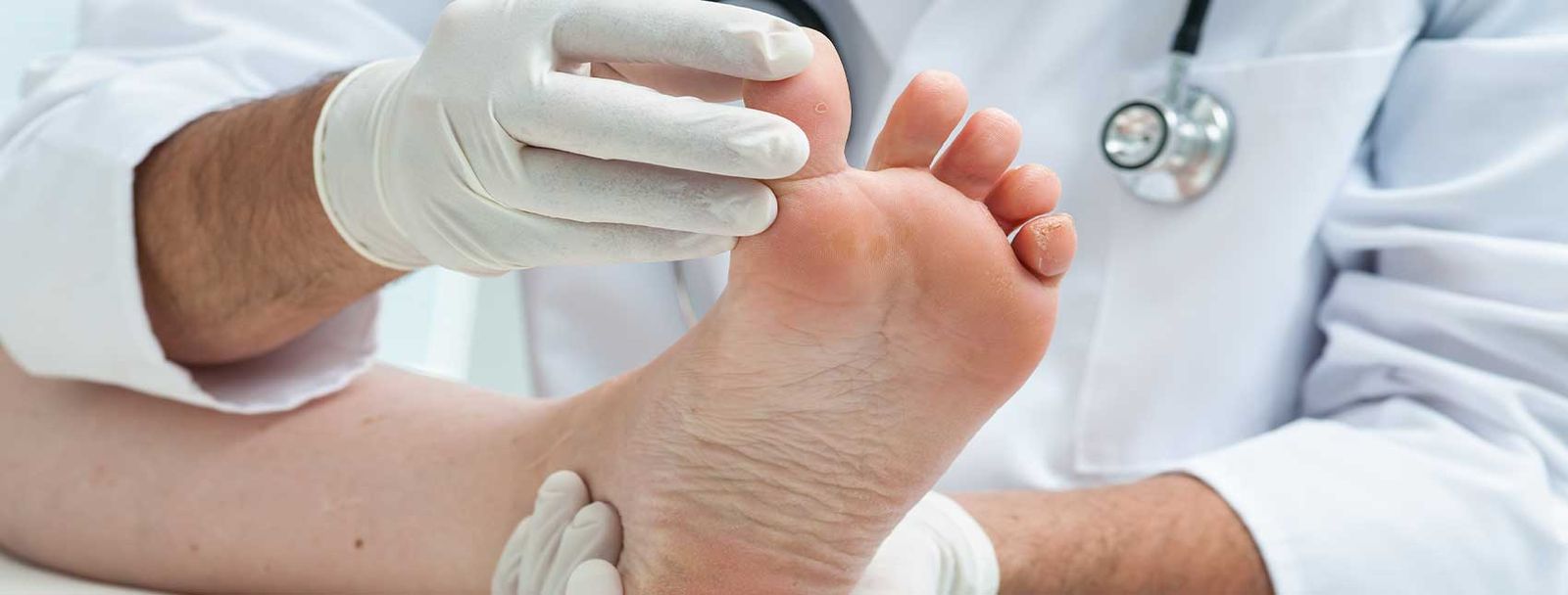 Doctor in white coat examining patient's swollen foot with gloved hands.