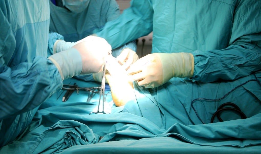 Compartment Syndrome Lawsuit Amputee Wins 6M Award