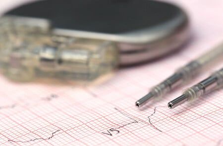 Pacemaker Death Patient Dies After Being Sent Home With Dysfunctional Pacemaker