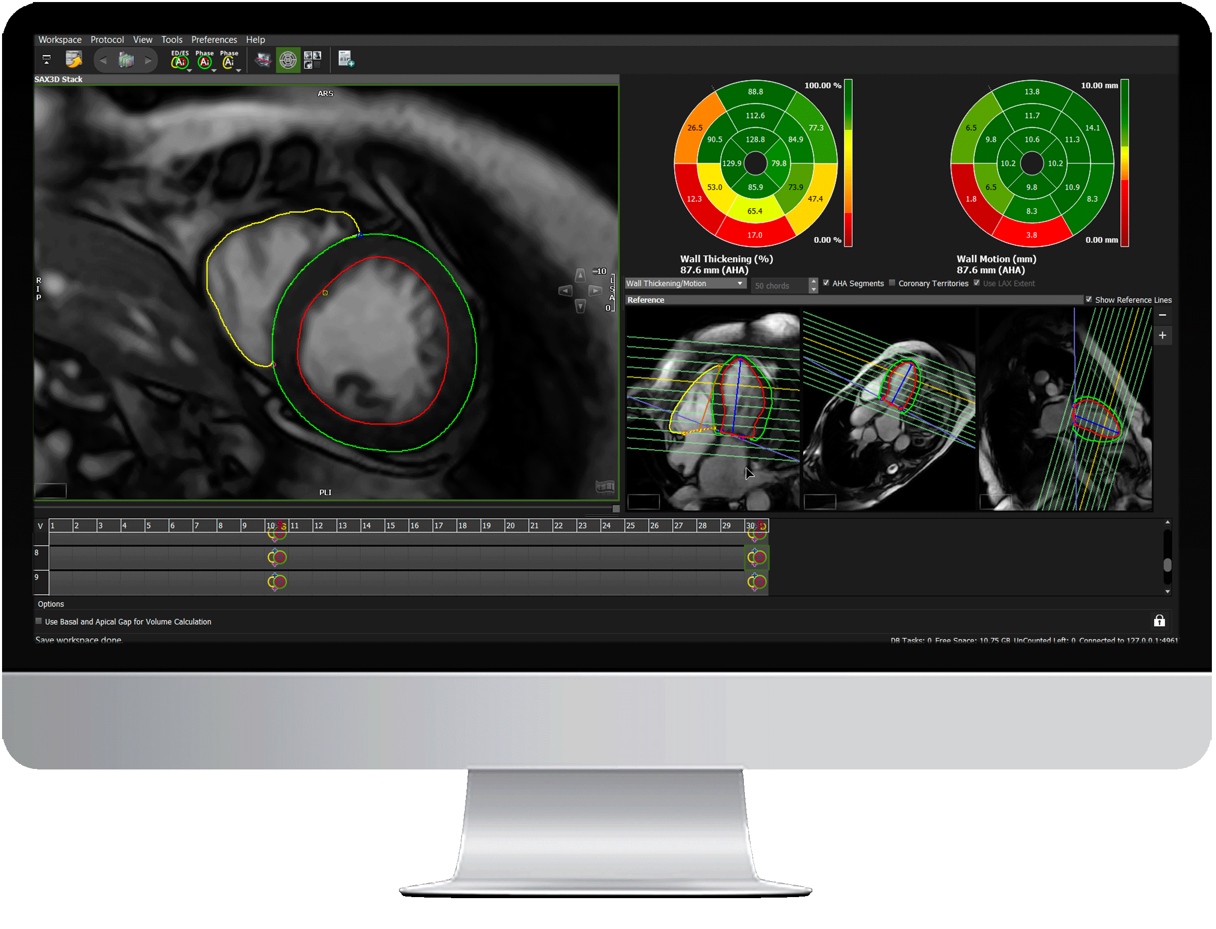 Mr Software Get Started | Circle Cardiovascular Imaging