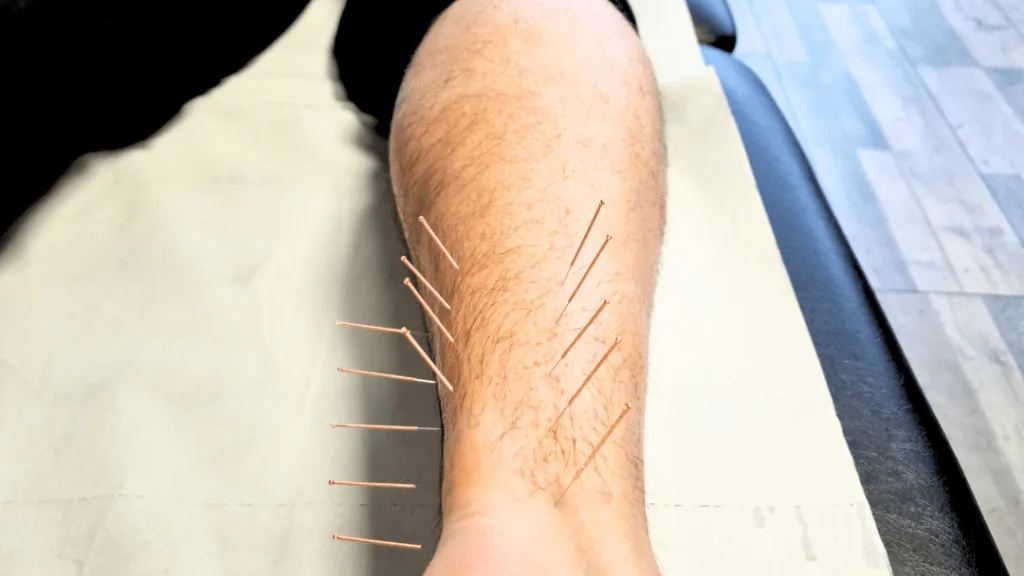Acupuncture – unlock the benefits! — figure 3