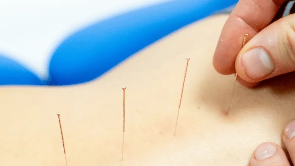 Acupuncture – unlock the benefits! — figure 2