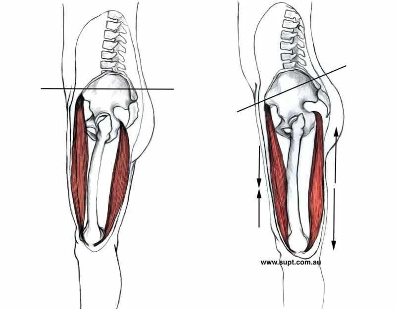 Hamstring Pelvic Tilt