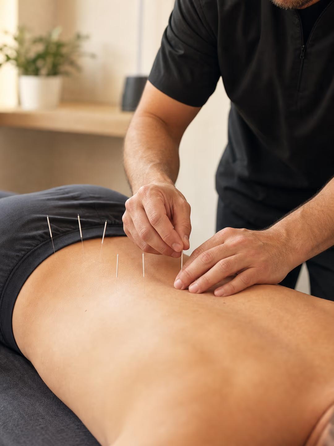 Acupuncture treatment session for chronic pain relief