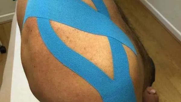 Kinesiology tape for shoulder impingement