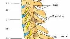 di-cspine-lateral250