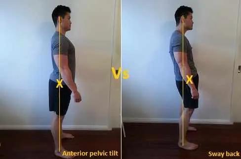 pelvic tilt