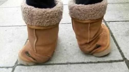 UGG Boots Overpronation