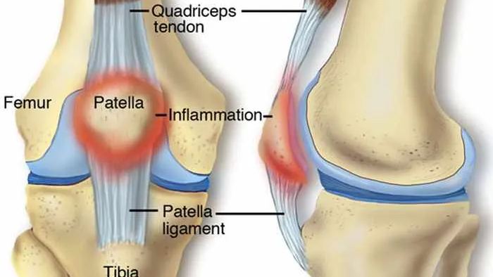 knee pain manchester