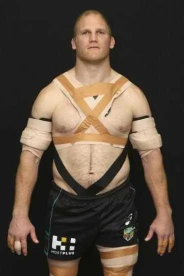 A day in the life of a Rugby Physio — figure 2