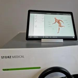 Revolutionizing Plantar Fasciitis Treatment: The Role of Shockwave Therapy — figure 2