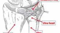 TFCC Anatomy