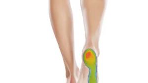 How Footscan Servicing Can Help with Foot and Ankle Pain — figure 2